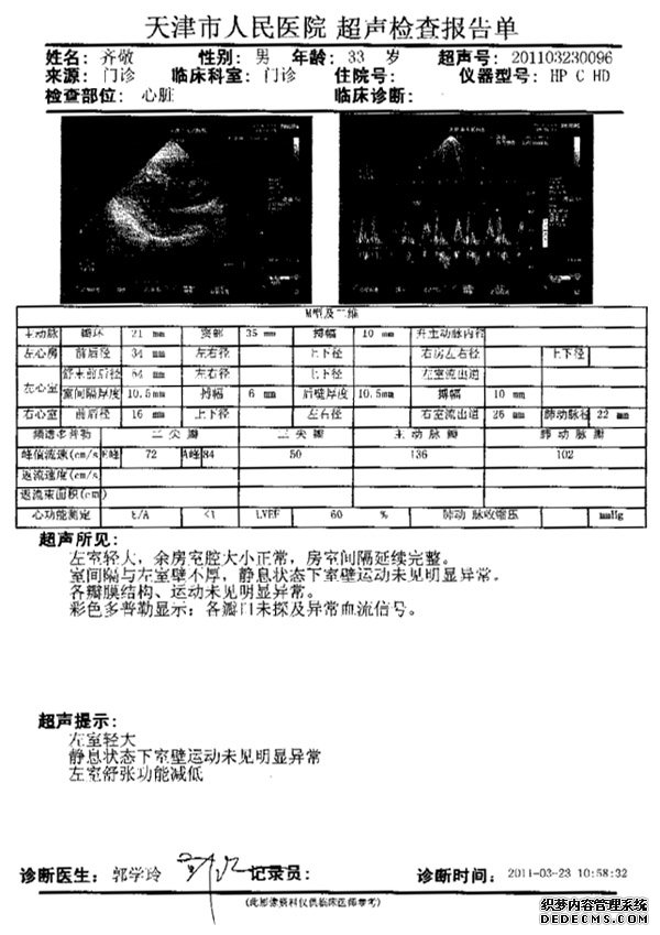 天津扩张型心肌病患者通过10个月完全康复病例分析