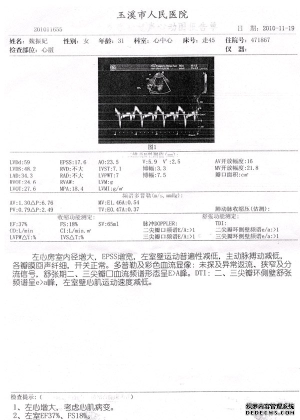 云南玉溪围产期心肌病患者4个月治疗后基本痊愈病例解析