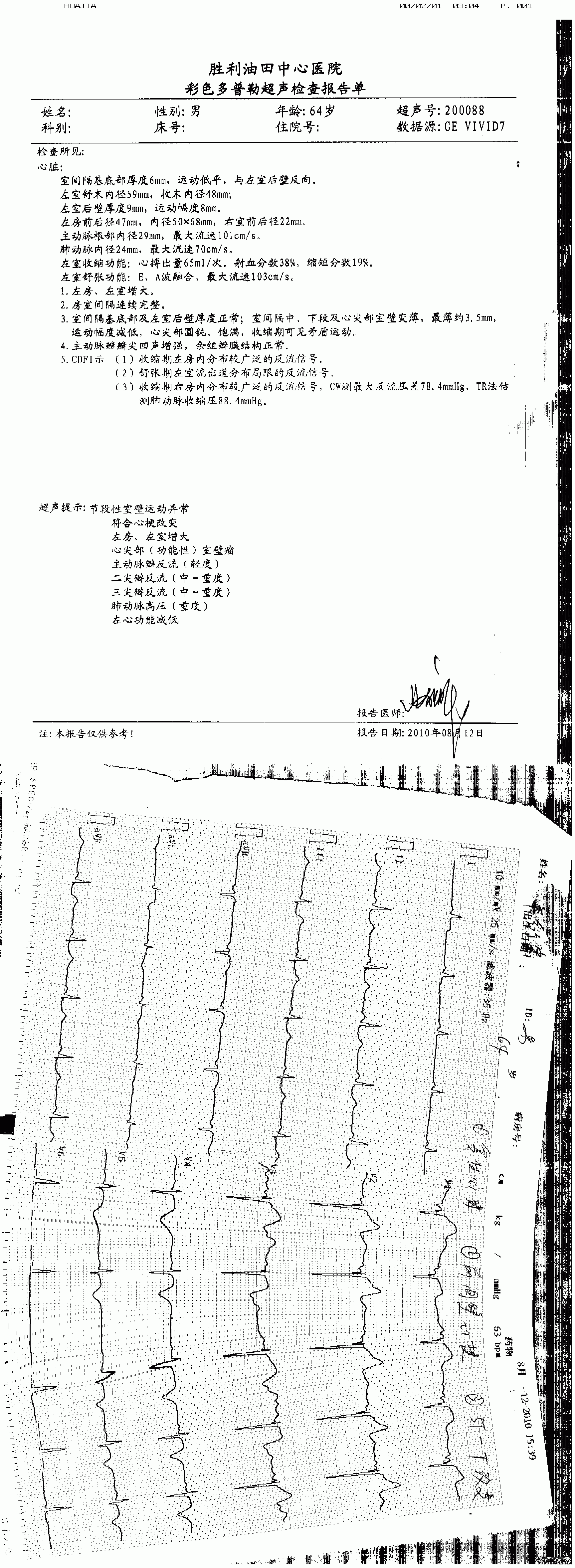山东东营64岁老年冠心病、心衰患者康复之路
