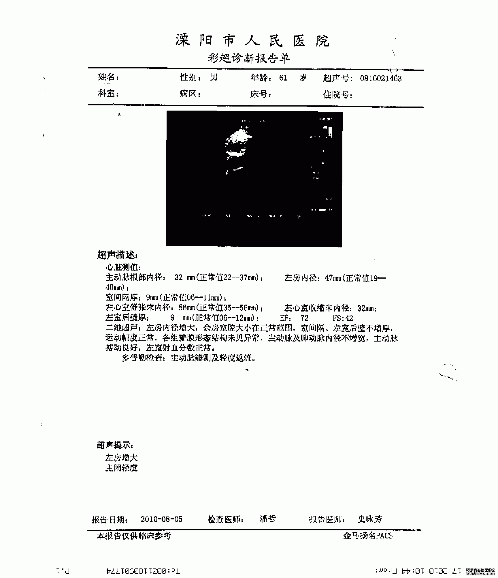 江苏溧阳61岁扩心病患者通过两个月治疗后康复