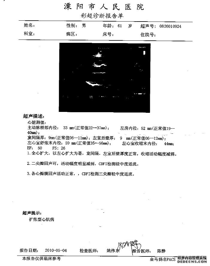 江苏溧阳61岁扩心病患者通过两个月治疗后康复
