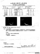 山西吕梁扩心病心衰，康复后不再反复的成功案例
