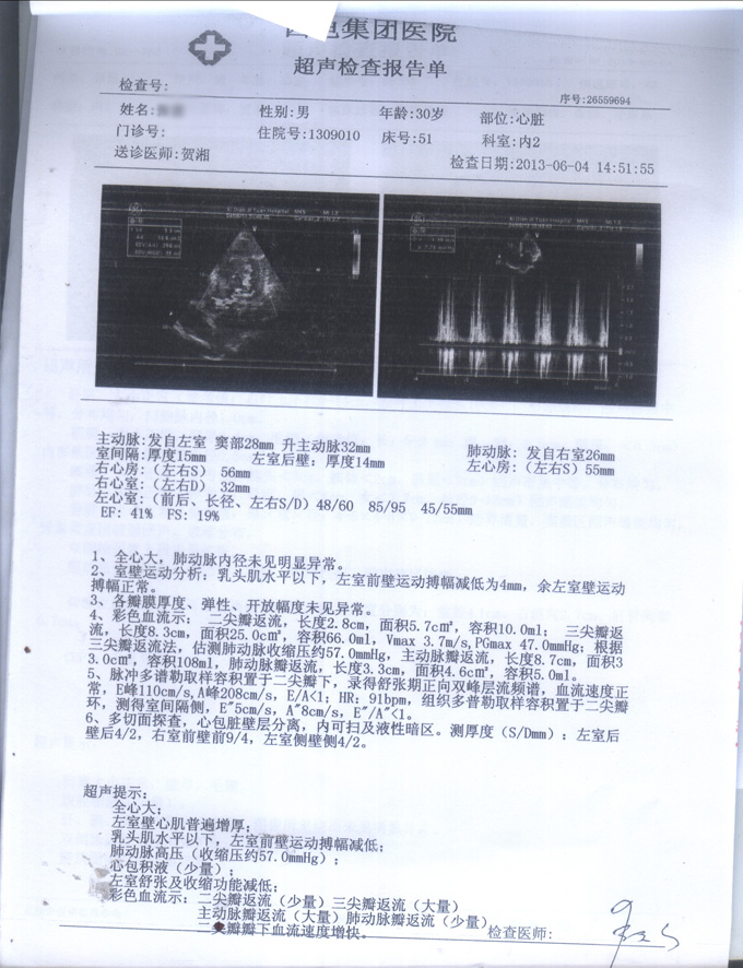 心肌细胞修复法 可以缩小您的大心脏