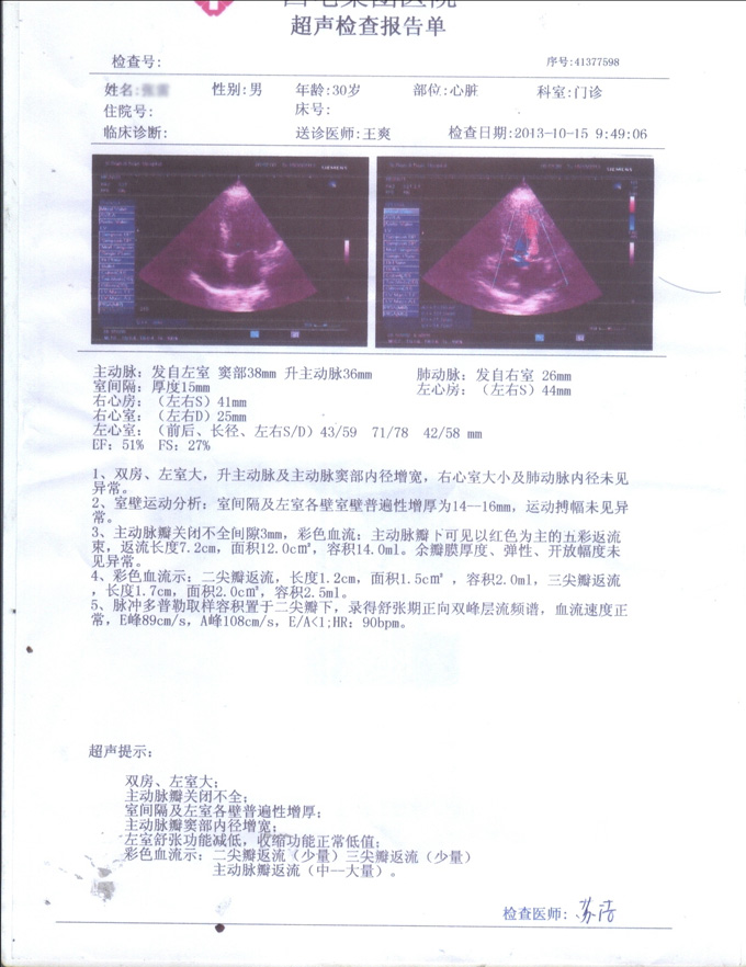 心肌细胞修复法 可以缩小您的大心脏