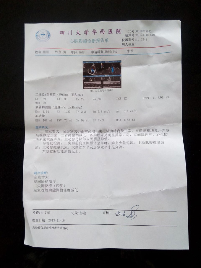 扩张型心肌病