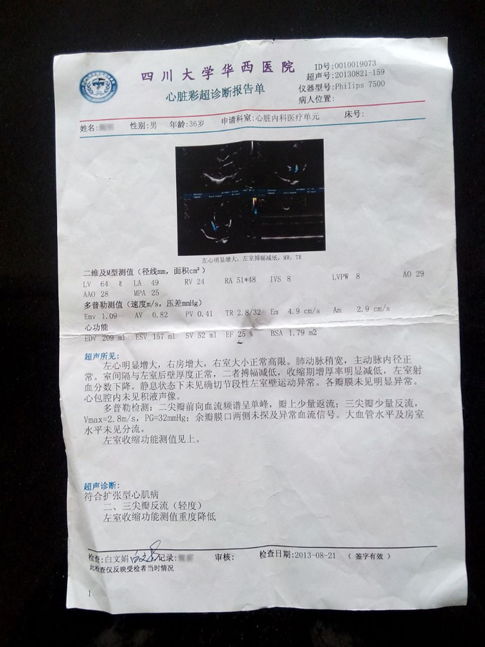 扩张型心肌病