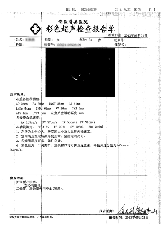 围产期心肌病大心脏能缩小吗
