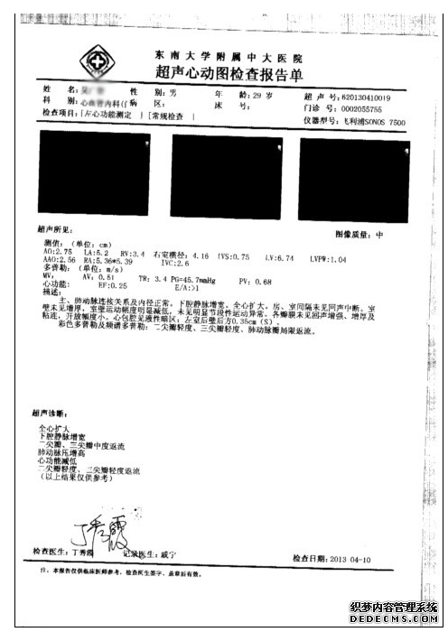 贾江俊教授解答：扩张型心肌病能活多久