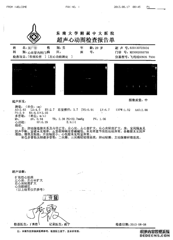 贾江俊教授解答：扩张型心肌病能活多久