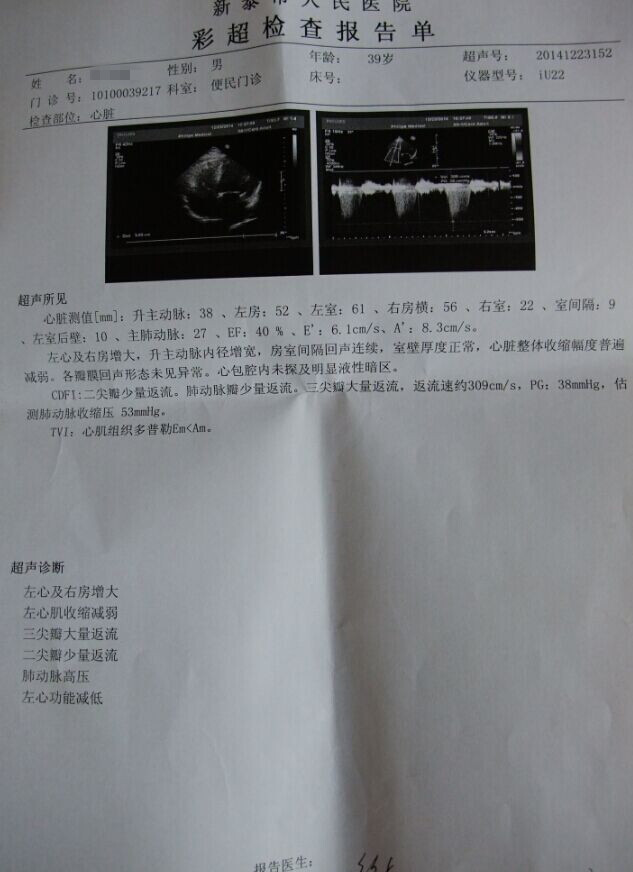扩张型心肌病该怎么治好？贾江俊教授救助扩张型心肌病心脏缩小真实病例