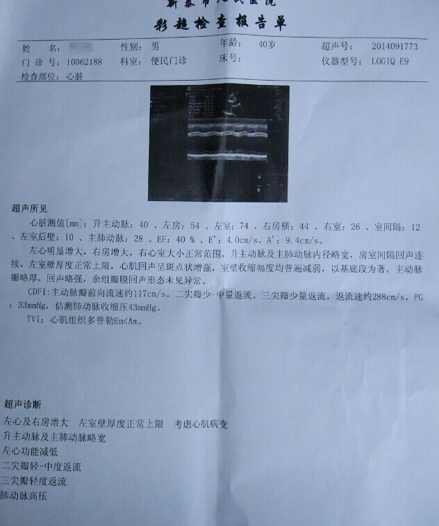 扩张型心肌病该怎么治好？贾江俊教授救助扩张型心肌病心脏缩小真实病例