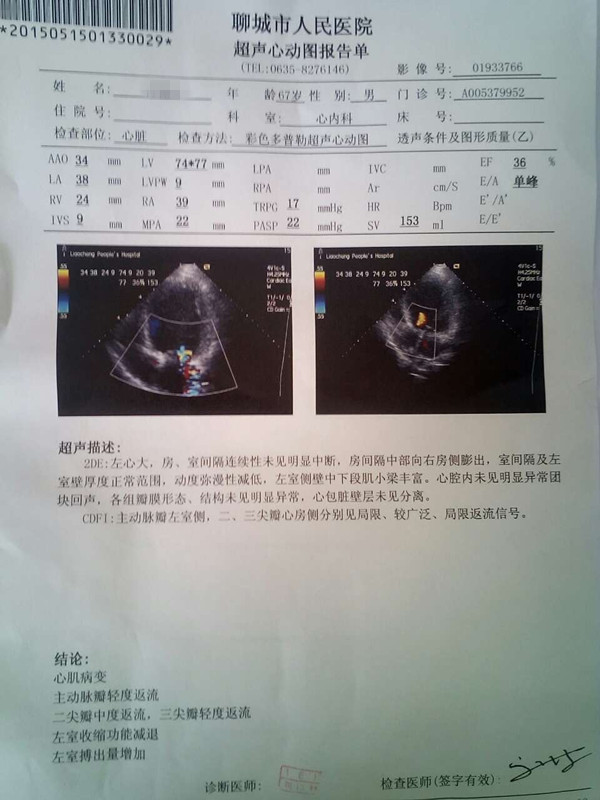 还能活多久？ 扩张型心肌病该如何治疗？贾主任救治真实病例