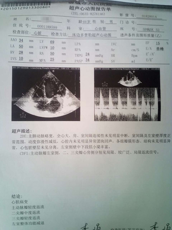 还能活多久？ 扩张型心肌病该如何治疗？贾主任救治真实病例
