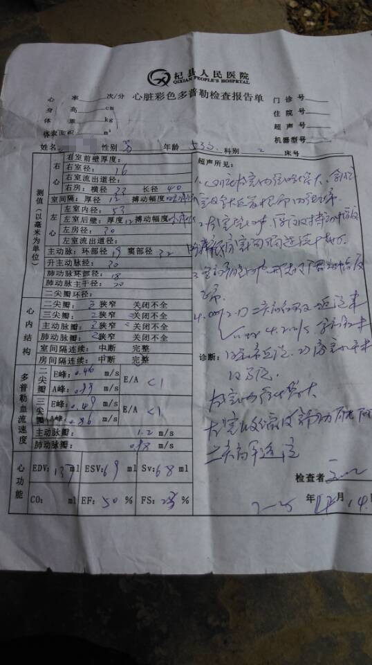 大心脏能缩小是真的吗？贾江俊教授救助扩张型心肌病患者大心脏缩小真实病例