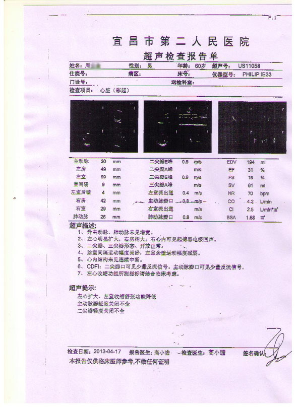 哪家医院治疗扩张型心肌病效果好