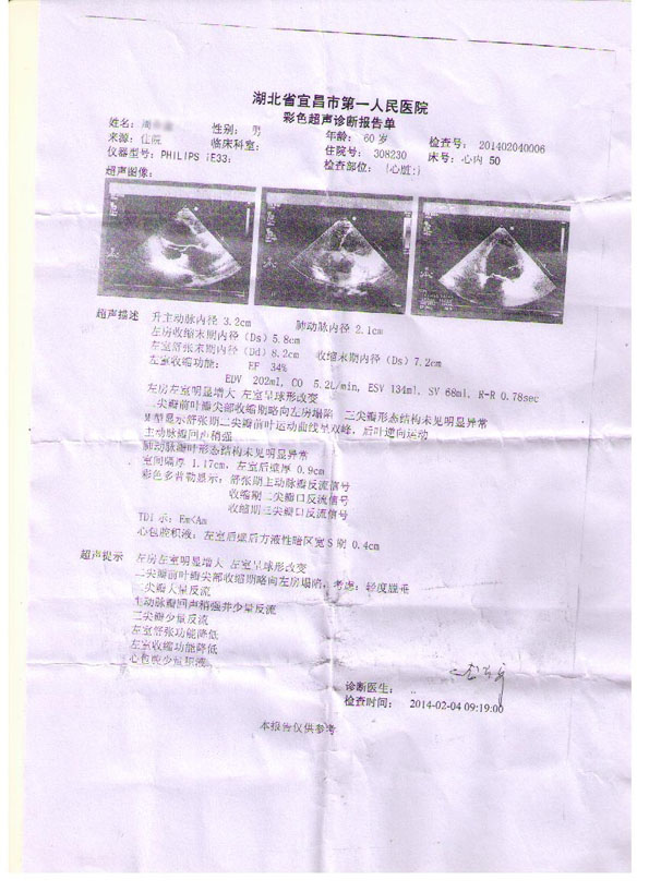 哪家医院治疗扩张型心肌病效果好