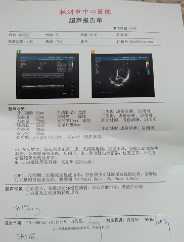 心肌病权威专家全方面解读“心脏扩大”的治疗