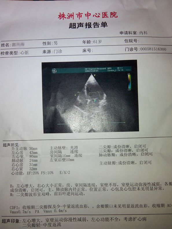 心肌病权威专家全方面解读“心脏扩大”的治疗
