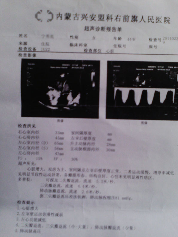 治疗手段创新、为扩张型心肌病患者重扬生命风帆