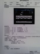 内蒙兴安 扩张型心肌病病史3年康复案例