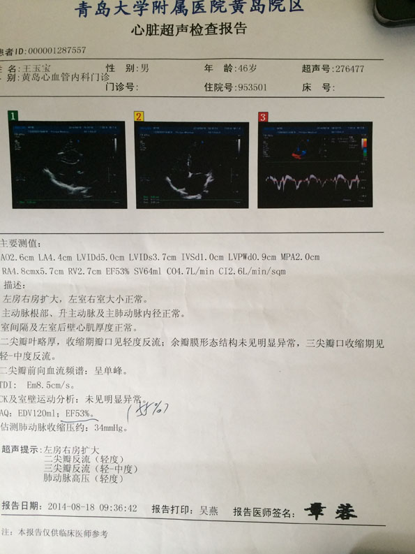 扩张型心肌病有什么好的治疗办法吗？