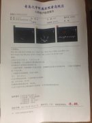 山东青岛患者，扩张型心肌病，左心扩大，伴心衰案例