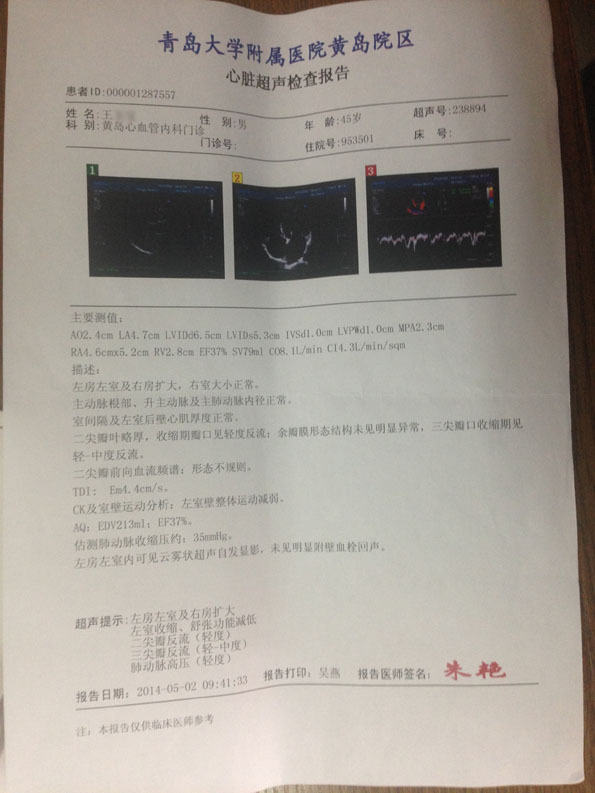 扩张型心肌病有什么好的治疗办法吗？