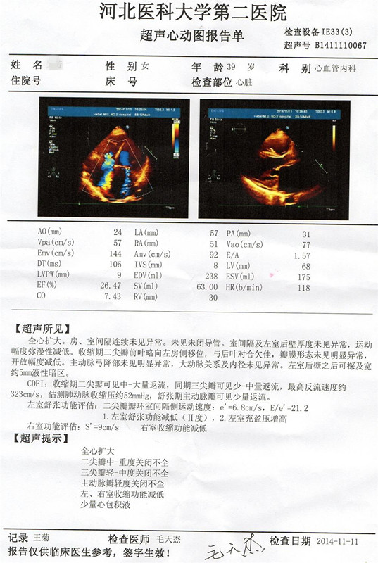围产期心肌病怎么治？心脏能缩小吗？经贾江俊教授救治重症围产期心肌病真实病例