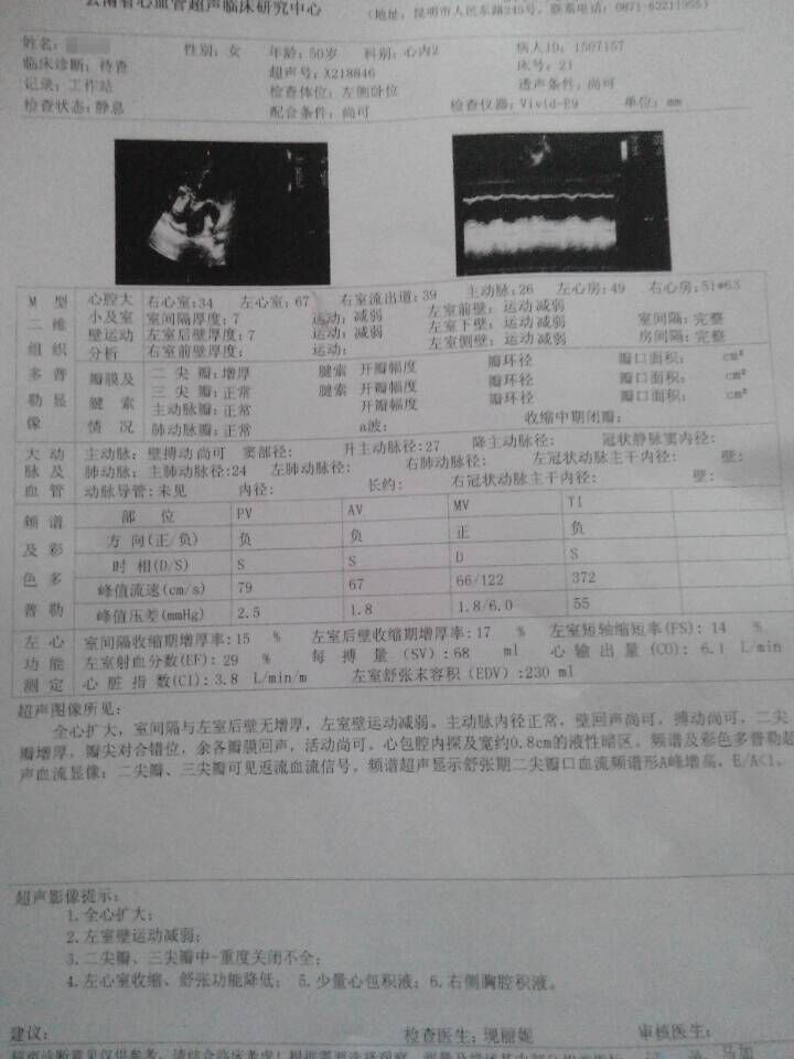 心脏扩大能治好吗？贾江俊教授救助心脏扩大真实病例