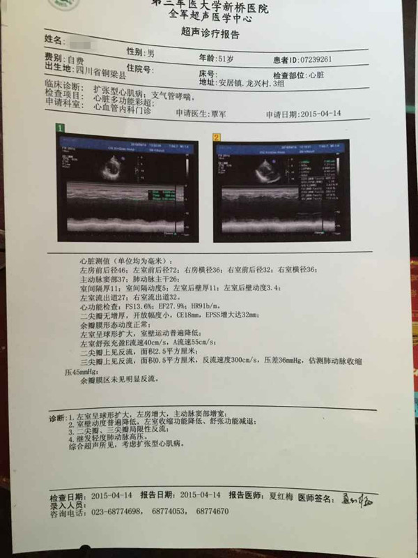 大心脏能缩小吗？贾主任救助扩心病患者心脏缩小真实病例