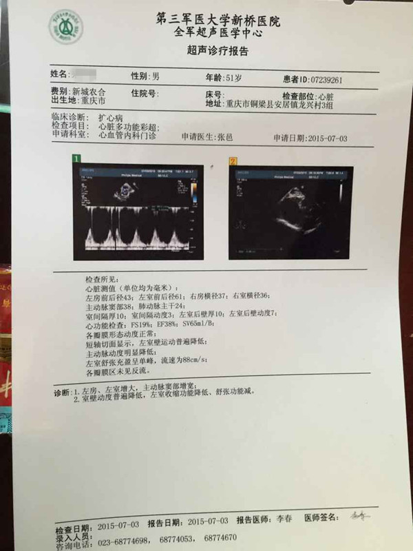 大心脏能缩小吗？贾主任救助扩心病患者心脏缩小真实病例